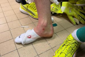 舍瓦利耶談被踢傷：有時(shí)候有些動(dòng)作必須避免，今天我算是非常幸運(yùn)