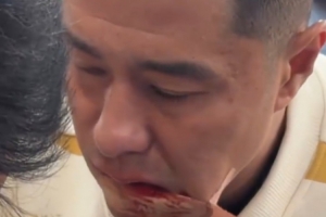 硬漢！國安足協(xié)杯奪冠后，侯森在場邊默默處理嘴部傷口